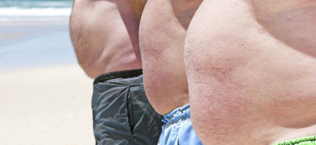 Epidemia nadwagi i otyłości