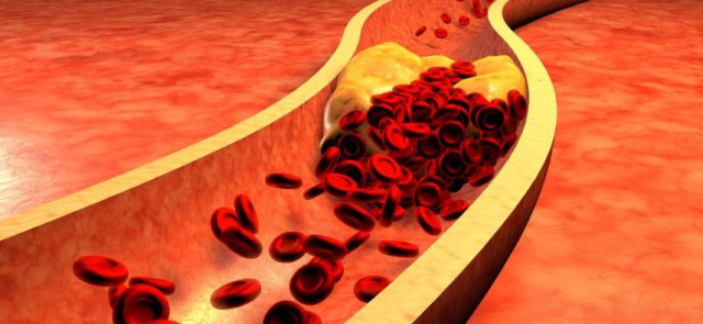 Mity związane z cholesterolem