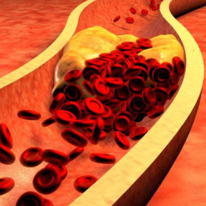 Mity związane z cholesterolem