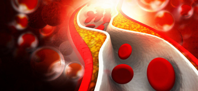 Wpływ sauny na poziom cholesterolu
