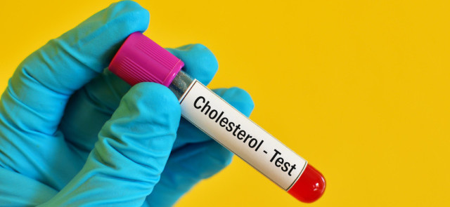 HDL – czy aby na pewno „dobry” cholesterol?