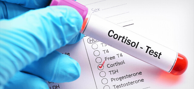 Kortyzol – zabójca sylwetki czy przyjaciel sportowca?