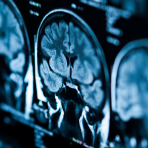 Ile trenować, by spowolnić starzenie się mózgu — najnowsze badanie z 2026 roku!